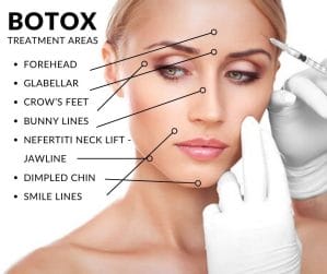 Botox treatment areas Botox treatment areas
