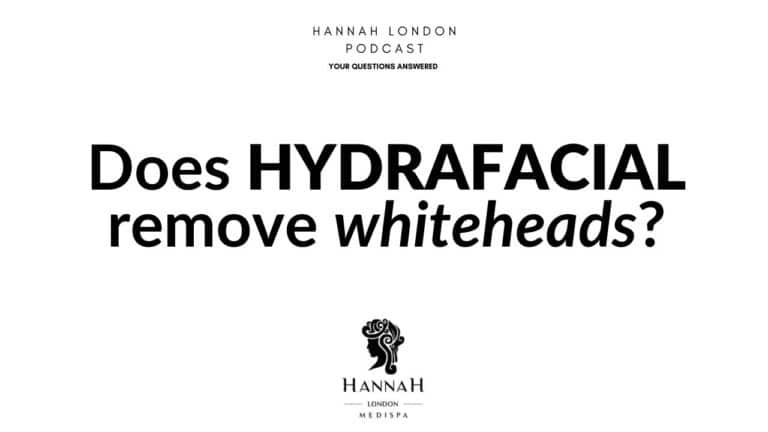 Does HydraFacial remove whiteheads?