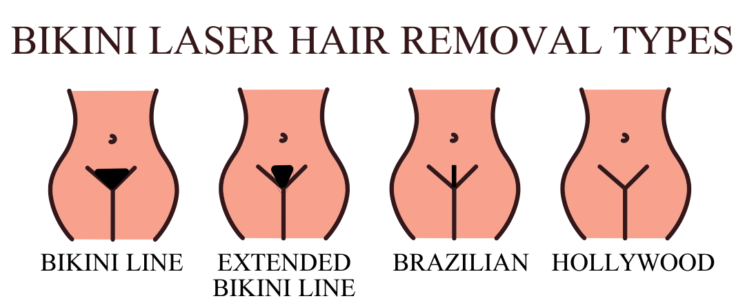Hannah London - Bikini Laser Hair Removal Ty Pes